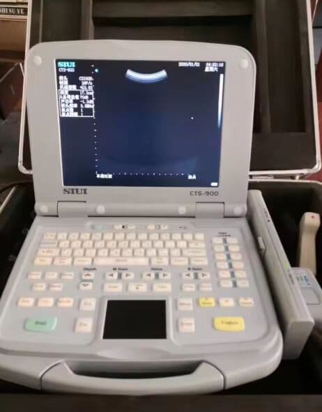 SIUI CTS-900 Ultrasound Scanner