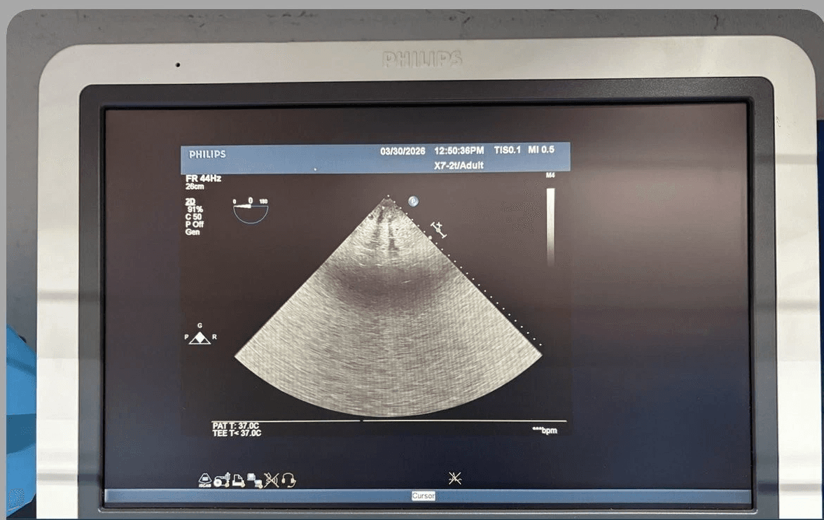 Philips X7-2t Live 3D TEE Ultrasound Probe for iU22 and iE33 Systems – xMATRIX PureWave Transesophageal Transducer