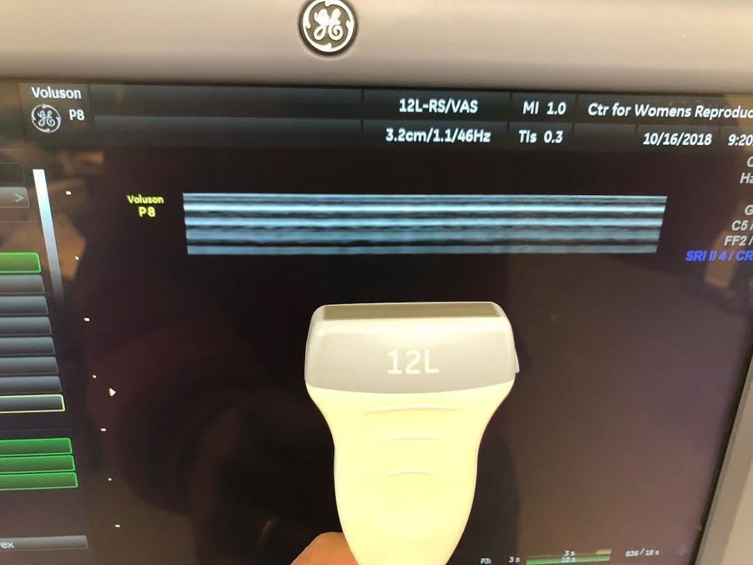 GE 12L-RS Linear Ultrasound Transducer