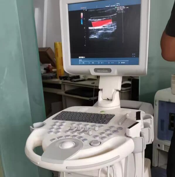 Medison SonoAce X6 Ultrasound System with 3 Probes