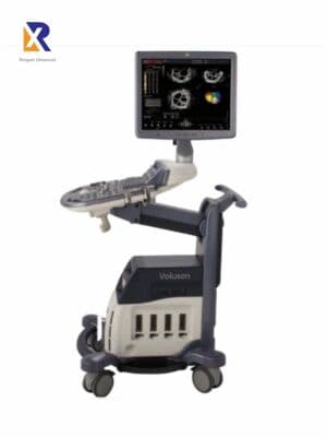 GE Voluson S6 OB/GYN Ultrasound System