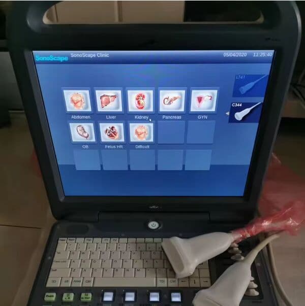 SonoScape S2 Portable Color Doppler Ultrasound System