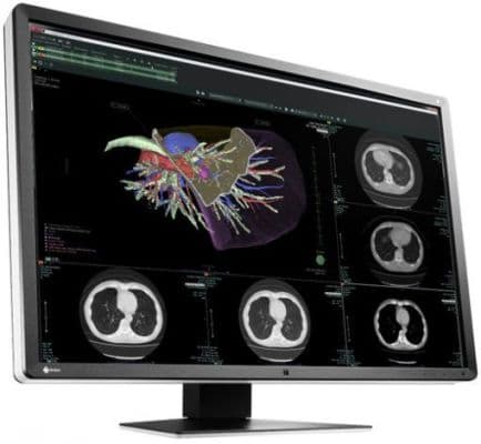 EIZO RadiForce RX660 6MP Color LCD Diagnostic Monitor
