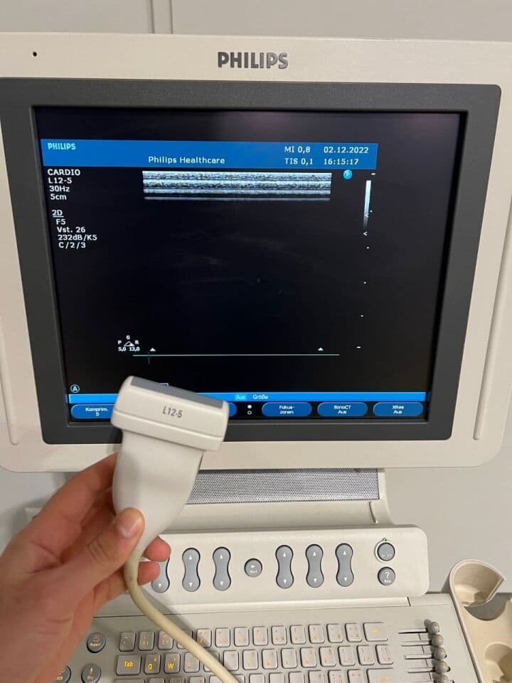 Philips HD11 General Ultrasound System