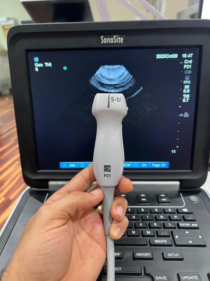SonoSite Edge Portable Ultrasound System