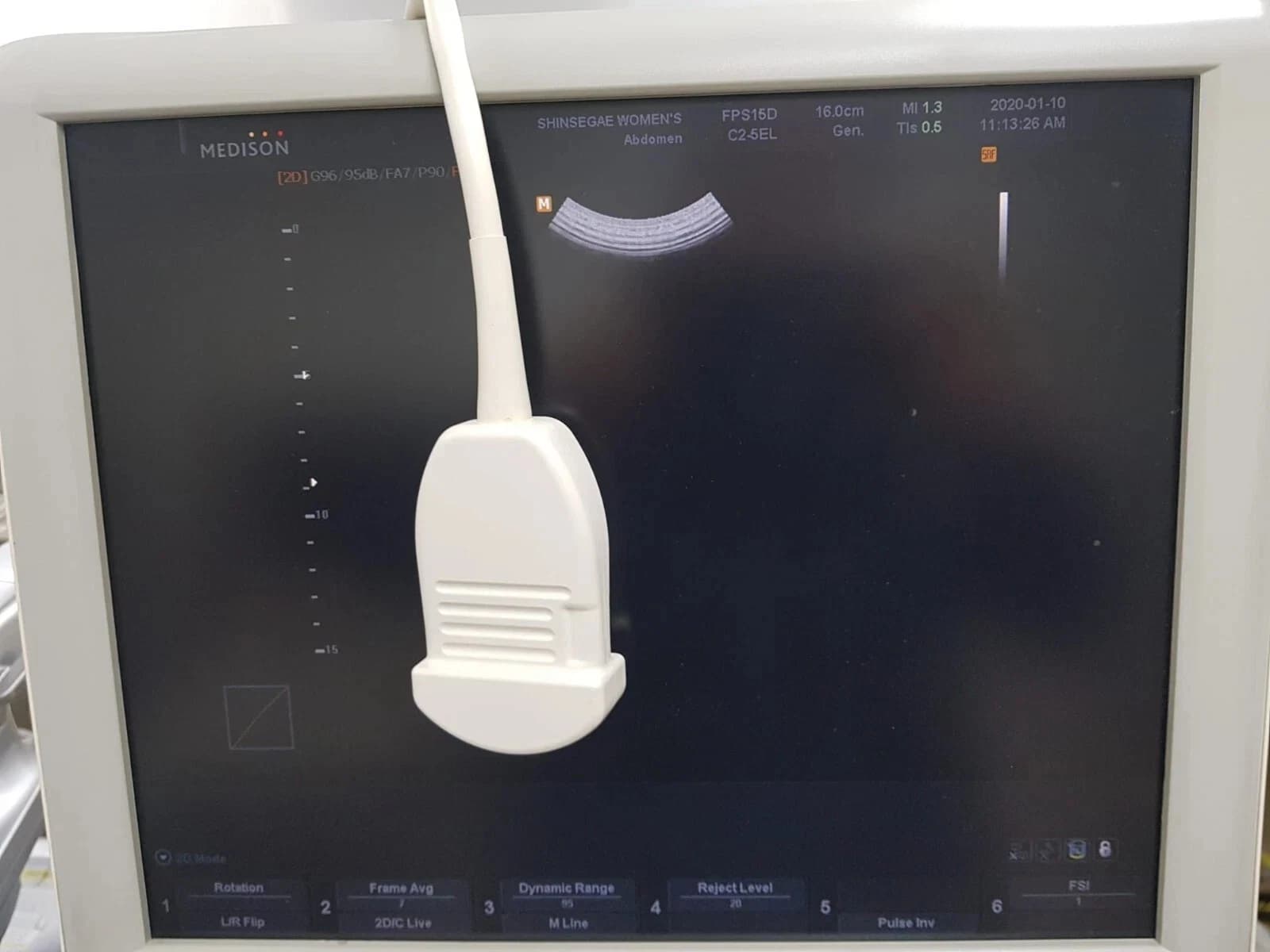 Samsung Medison C2-5EL Convex Ultrasound Probe for SonoAce and Accuvix Systems – Abdominal, OB/GYN and General Imaging