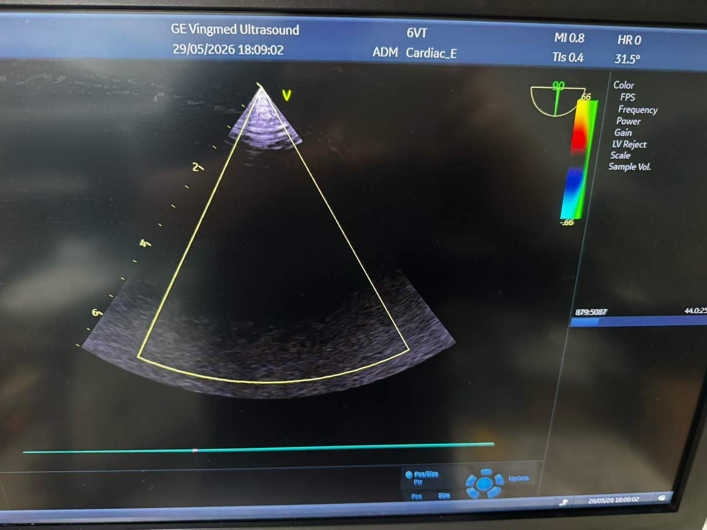 GE 6VT-D 4D TEE Matrix Array Ultrasound Probe for Vivid E9, E95 & Cardiac Systems