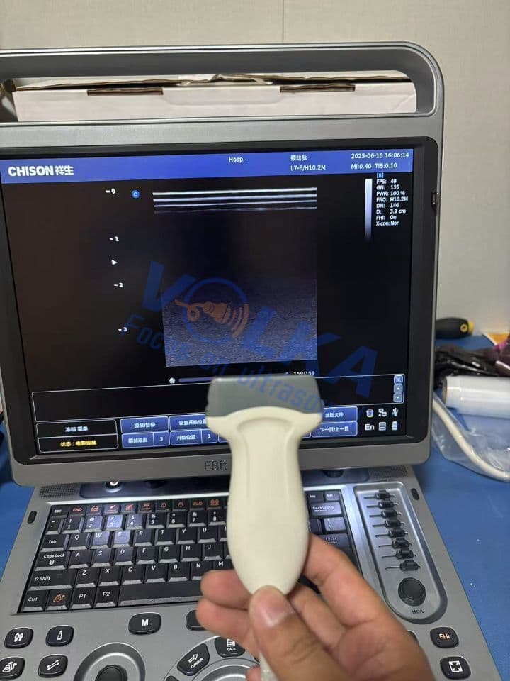 Chison L7-E Linear Ultrasound Transducer