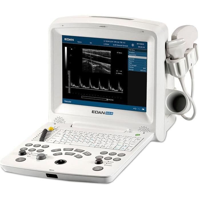 DUS 60 Compact Ultrasound System by Edan