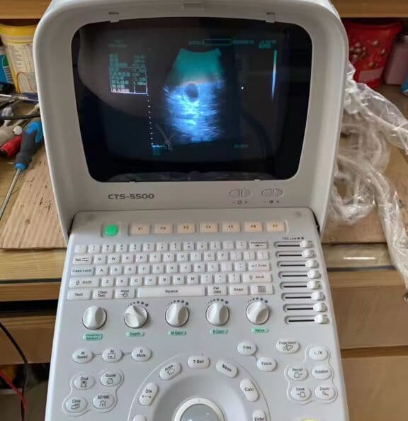 SIUI CTS 5500 Ultrasound Scanner