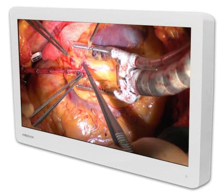 Ampronix MEDVIX AMVX2608HD 26-inch Surgical Display Monitor
