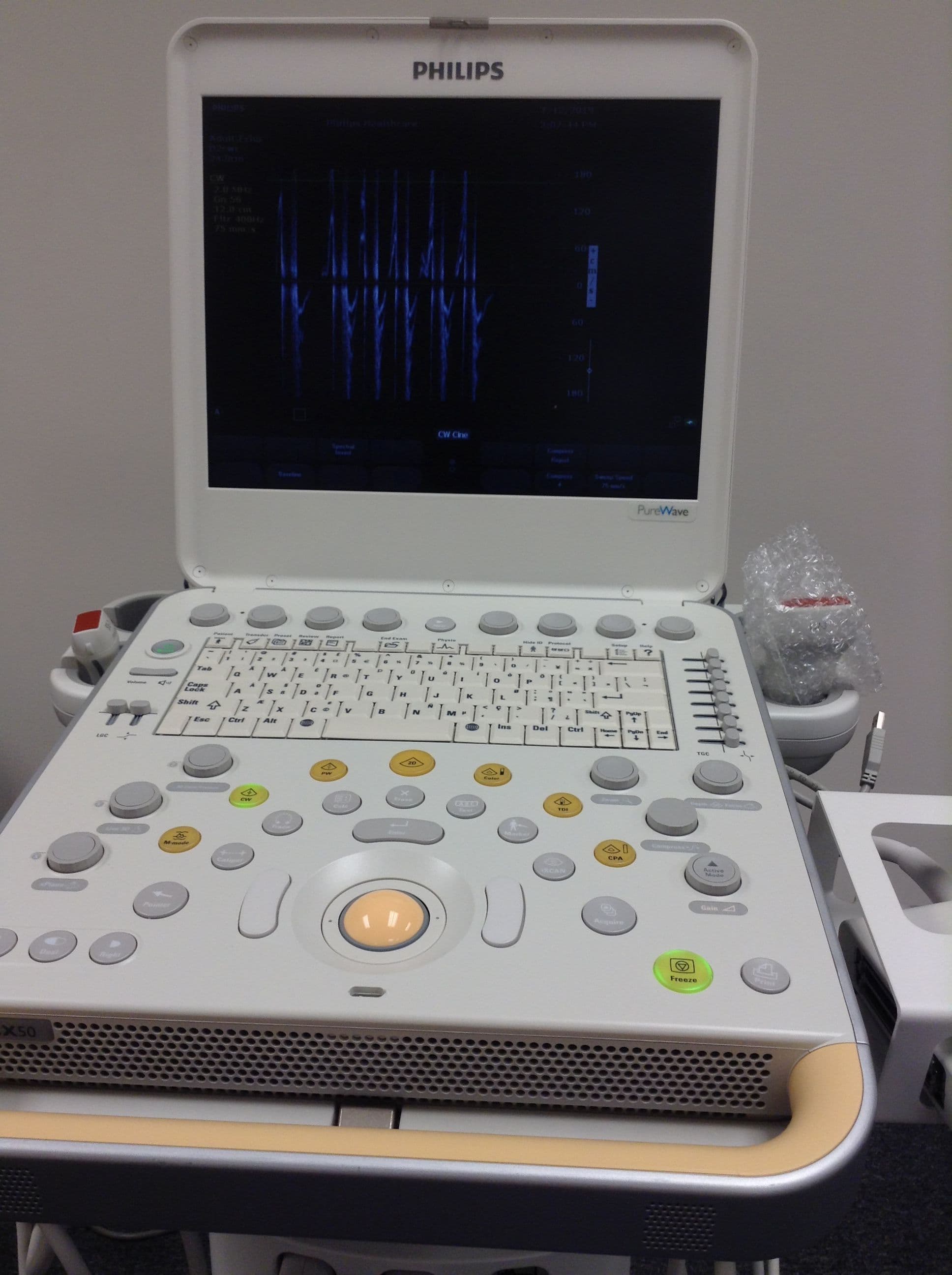 Repair and Maintenance Service for Philips CX50 Shared Service Ultrasound