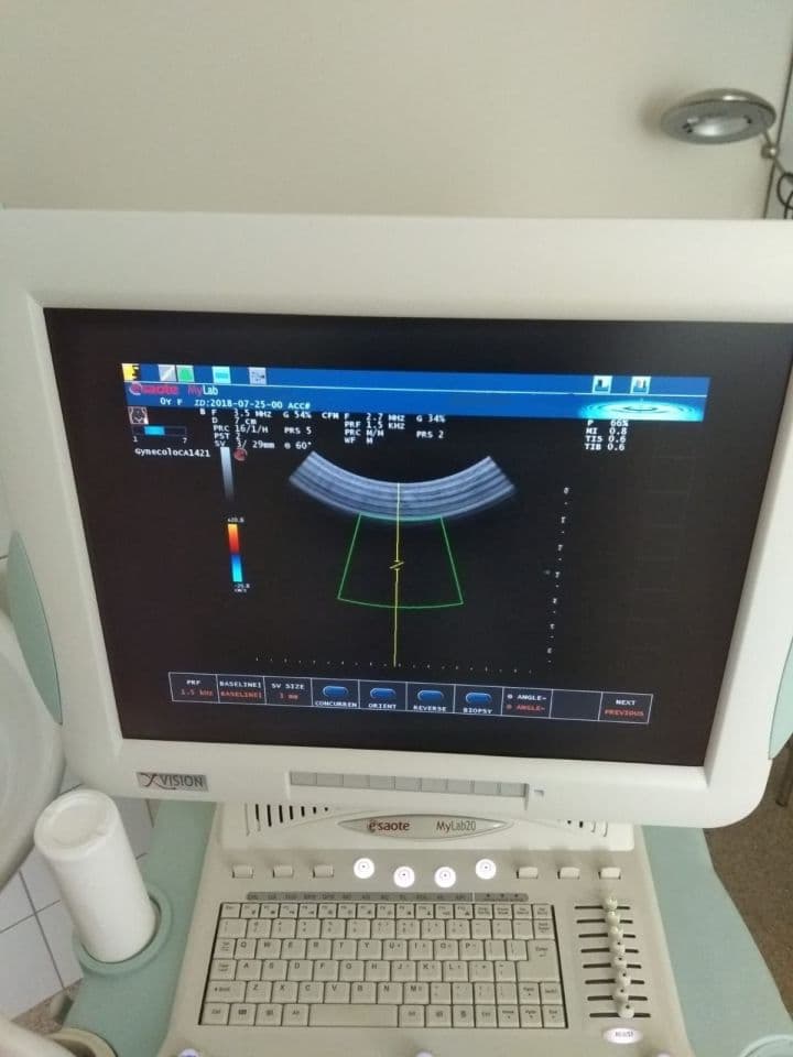 Esaote MyLab 20 OB/GYN and Vascular Ultrasound System
