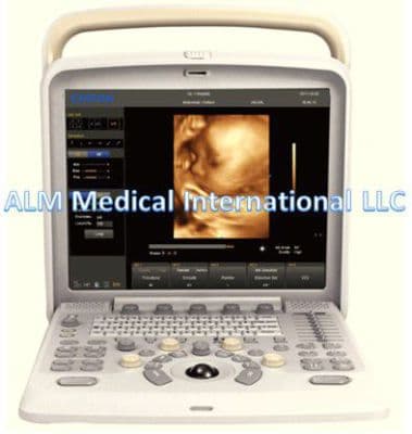 Chison Q5 Multi-Application Ultrasound System