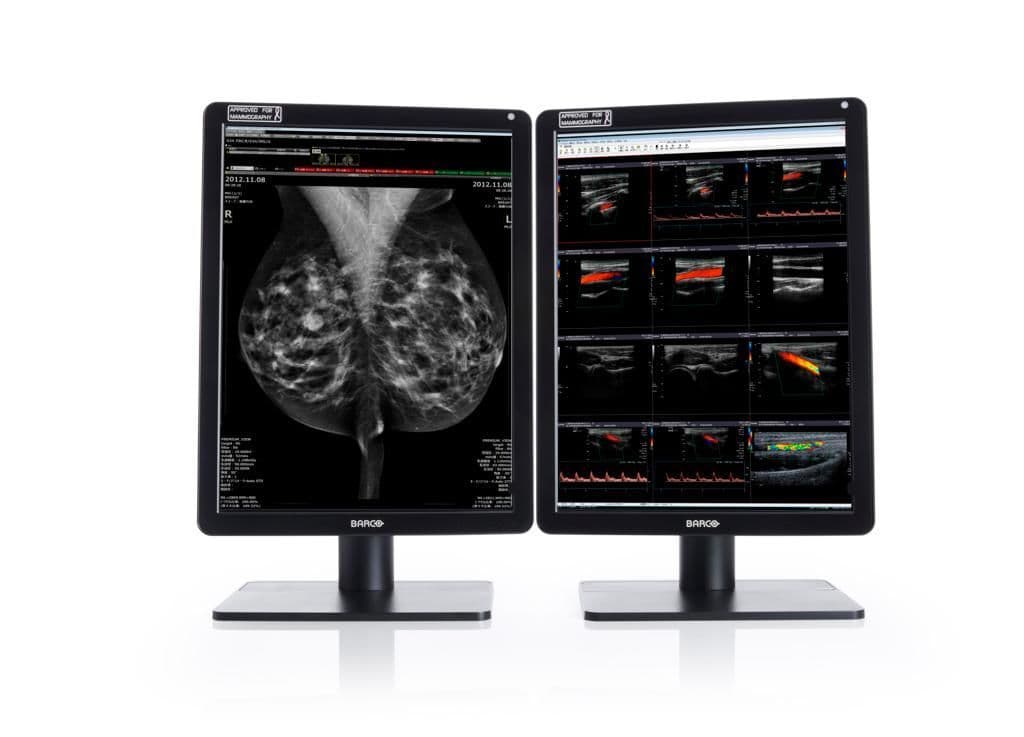 Diagnostic Color Imaging with the Barco Nio MDNC-6121 5MP Display Monitor