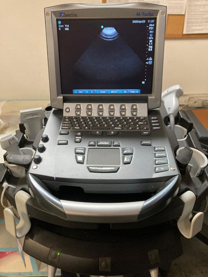 Sonosite M-Turbo Portable Shared Service Ultrasound System