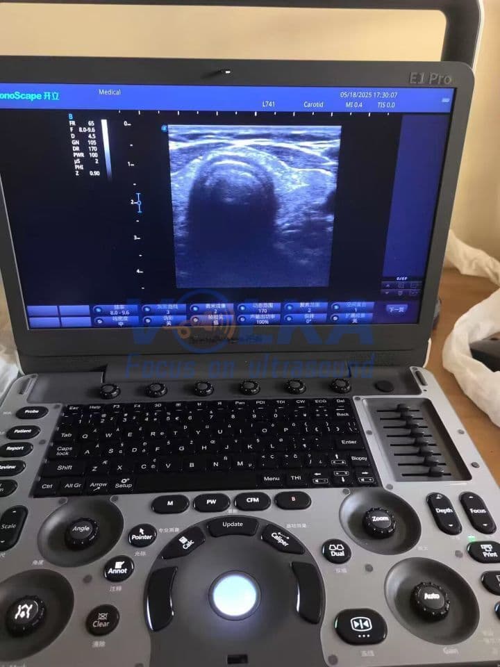 SonoScape L741 Linear Ultrasound Transducer