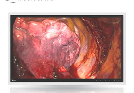 Clinical Review Display Monitor — Eizo RadiForce EX270W
