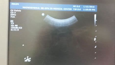 Philips C5-2 Curved Array Ultrasound Transducer