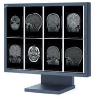 NEC MultiSync MD21GS-2MP Diagnostic Display Monitor