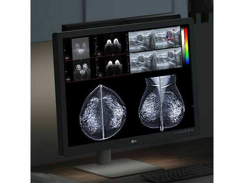 12MP Color Diagnostic Monitor: LG 31HN713D-B for PACS and Mammography