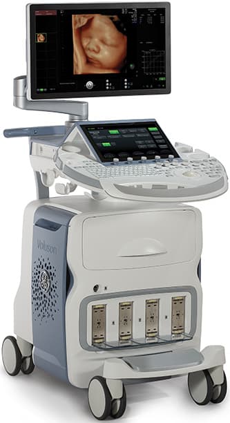GE Voluson E10