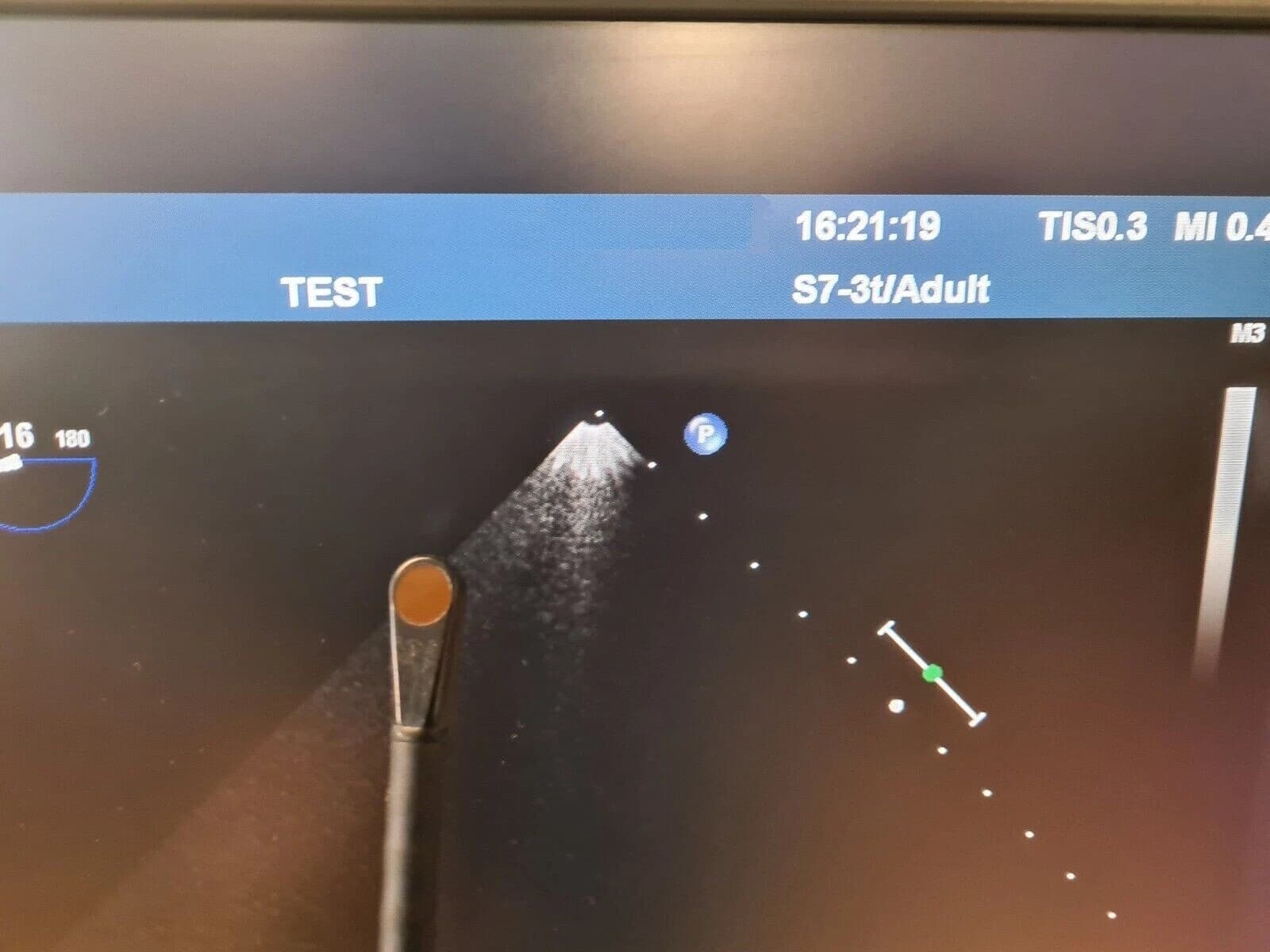 Philips S7-3t 2D TEE Ultrasound Transducer Probe for iU22 and iE33 Systems – Transesophageal Echocardiography Probe