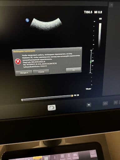 Philips Epiq Elite Ultrasound System