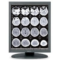 High-Resolution 3MP Sony LMD-DM30 Diagnostic Display Monitor