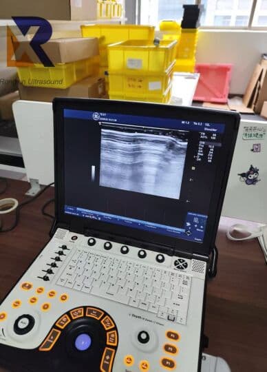 Portable GE LOGIQ e R9 Ultrasound System