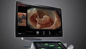 GE Voluson E10 BT21 Ultrasound System with OLED Monitor